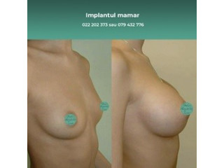 Implant mamar cea mai sănătoasă metodă de mărire a sânilor