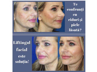 Lifting facial pentru un profil facial tânăr