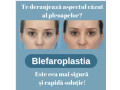 operatia-de-blefaroplastie-superioara-small-0