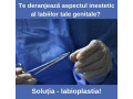 labioplastie-small-0