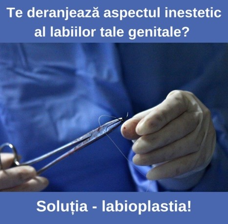 labioplastie-big-0