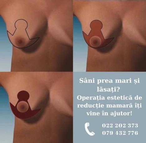operatie-de-reductie-mamara-big-0