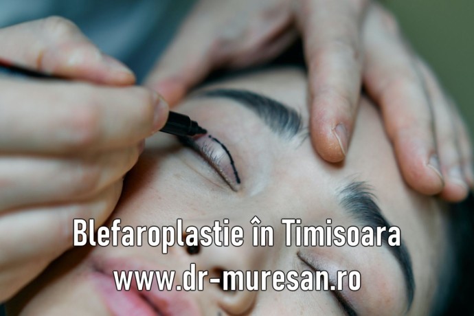 blefaroplastia-in-timisoara-rejuvenare-cu-10-ani-mai-tanar-big-0